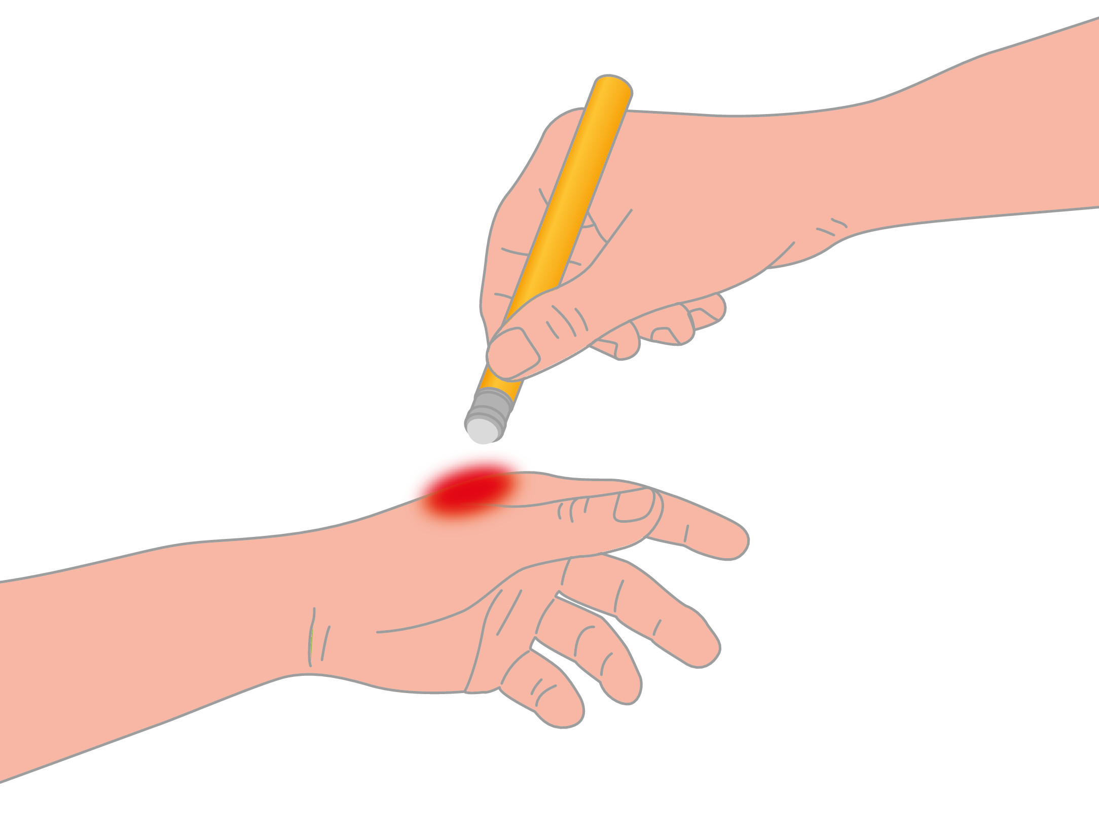 Penna lenitiva contro le punture di insetti - 16 ml - immagine 6